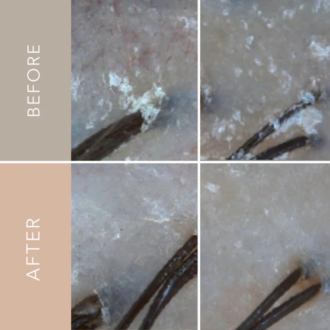 Scalp Purifying Microbiome Shampoo